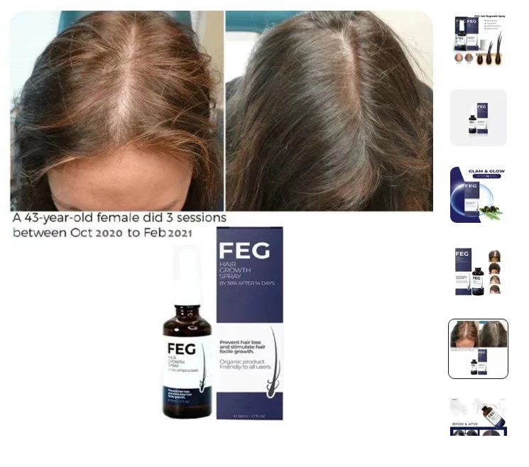 Hair Regrowth Spray